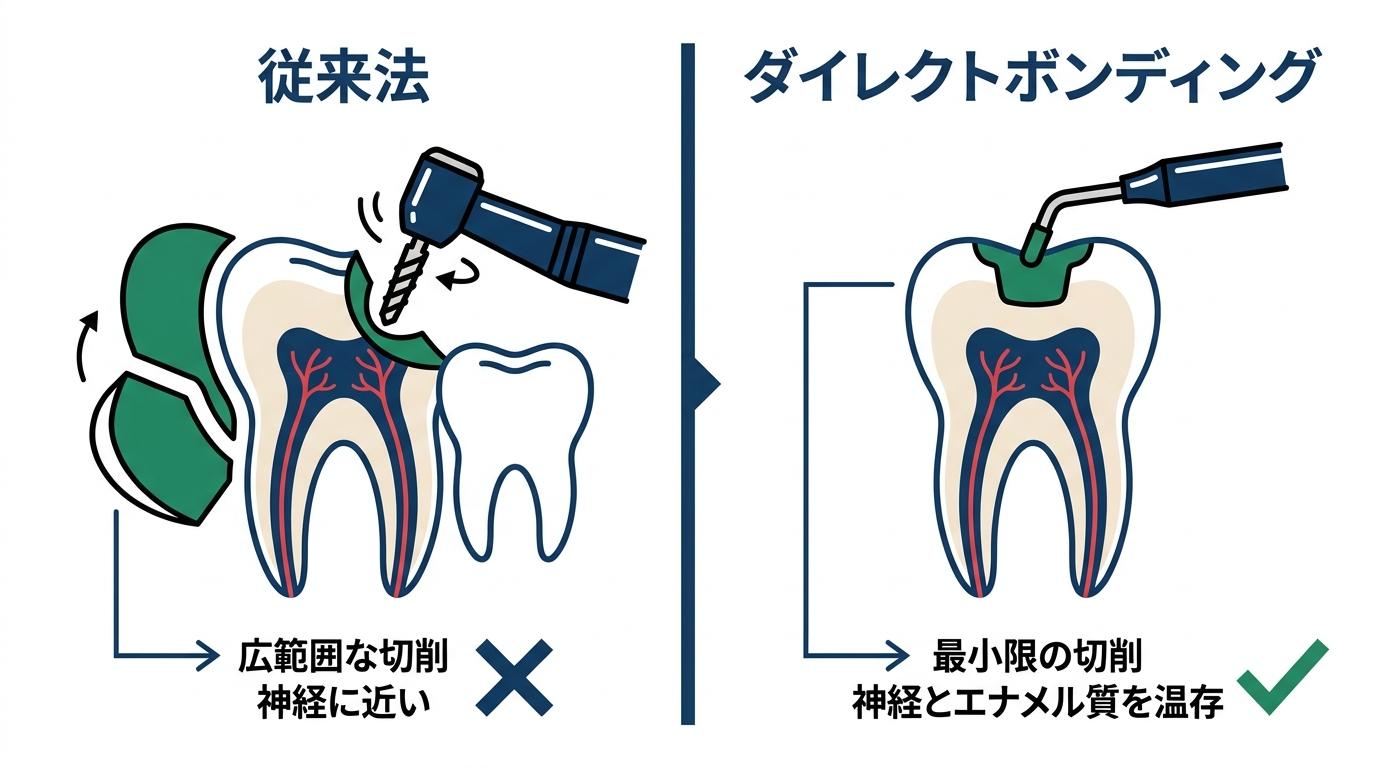 従来法と比較した歯への侵襲性の少なさの図解